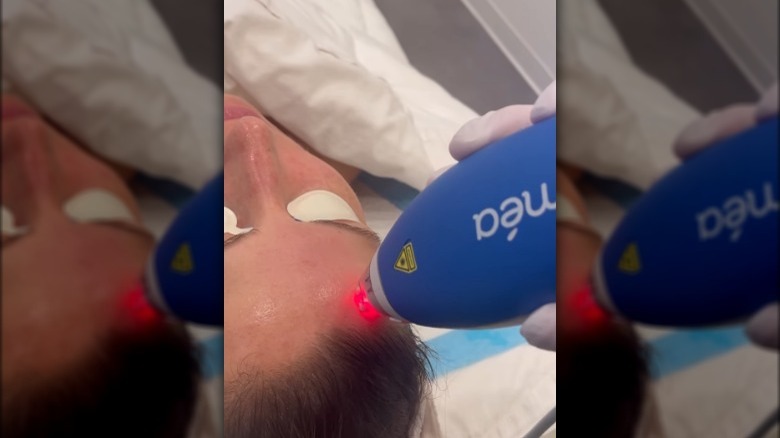 Women getting Clear + Brilliant Touch Laser treatment