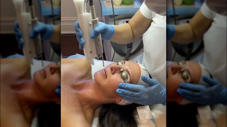 Woman getting Frac3 treatment