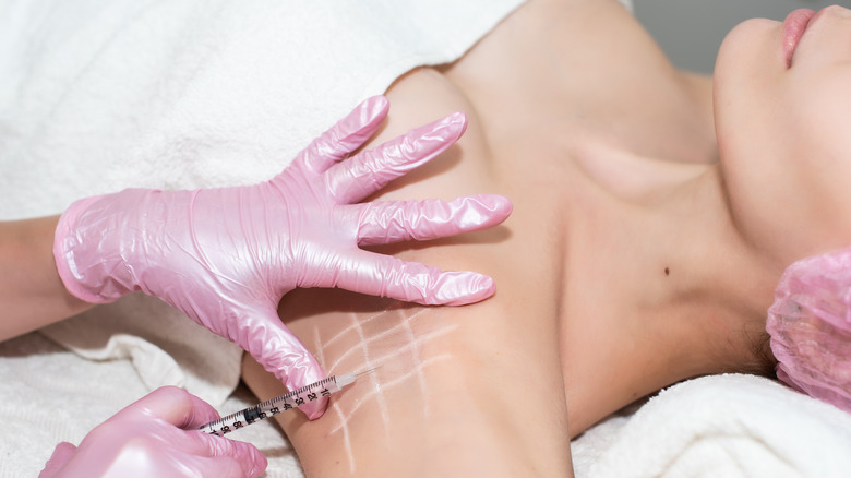 woman getting underarm botox