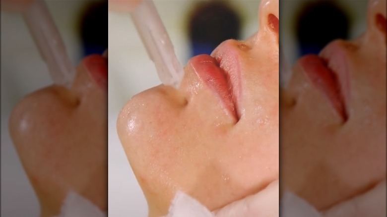 A Jet Peel facial