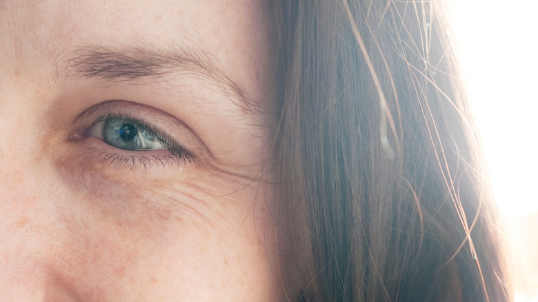 Wrinkles and fine lines