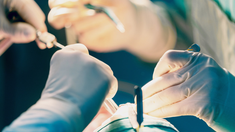 Surgeons operating on nose